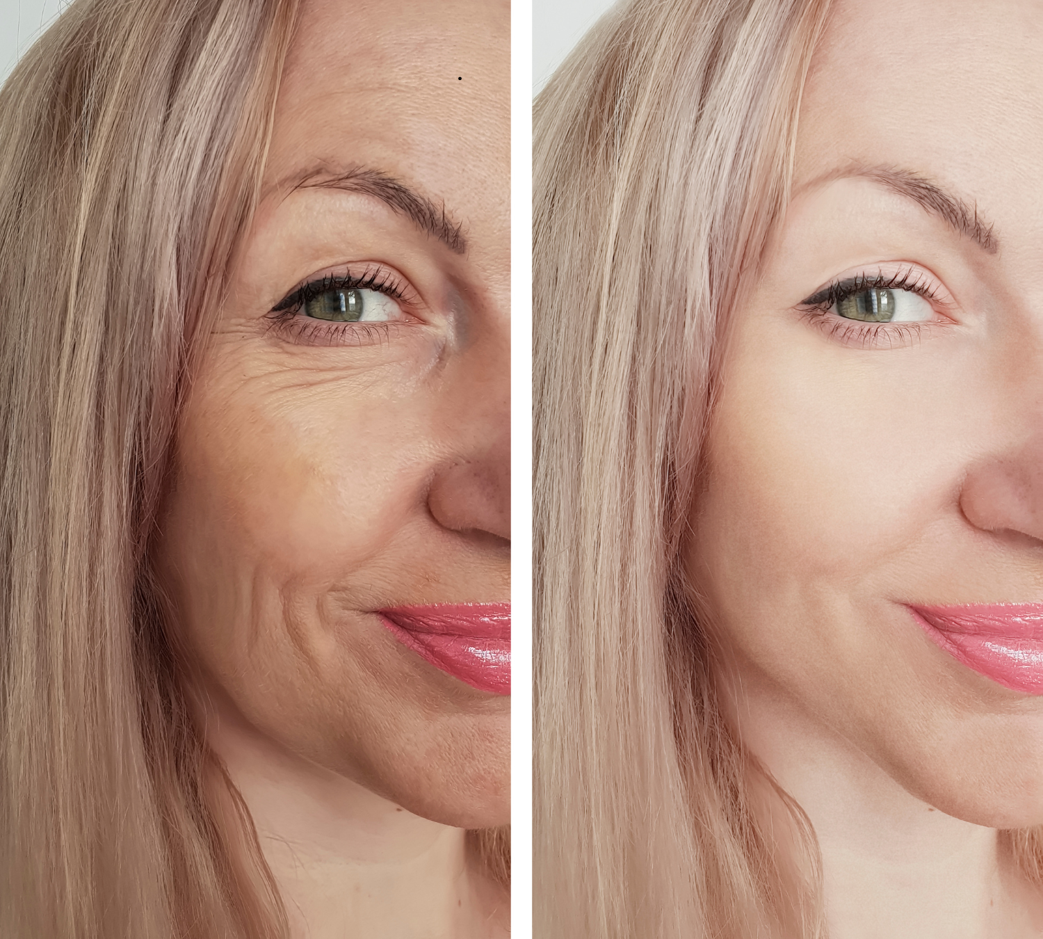 facial treatment near me