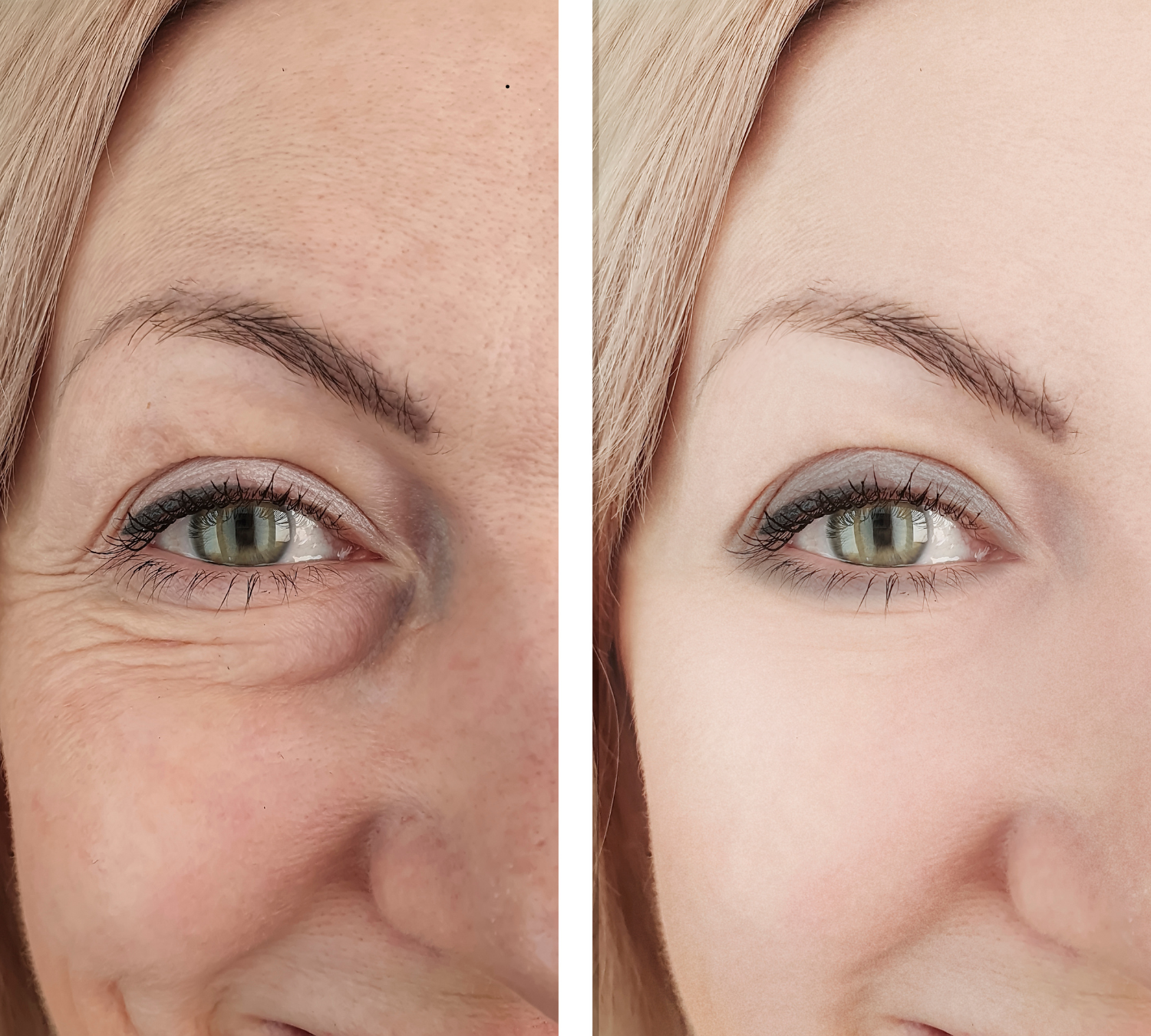 best facial salon in dehradun