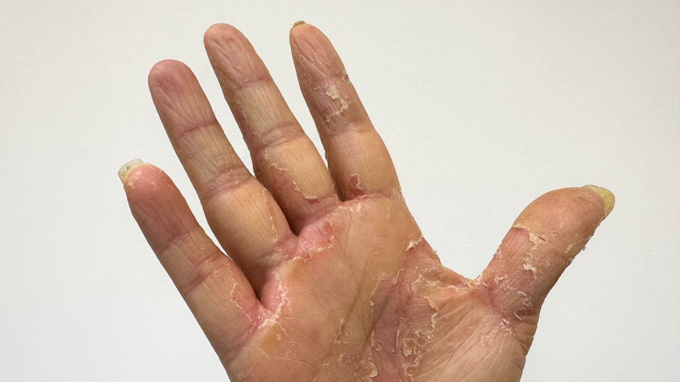 Dry hands before manicure treatment